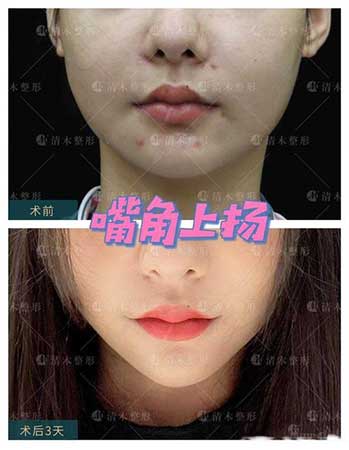 嘴角上扬下一句